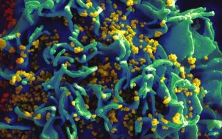 HIV-1 remission achieved in second patient