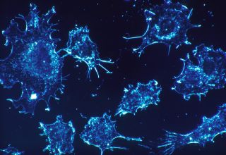UoM scientists have found a way to stop breast cancer cells from spreading