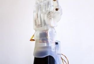 Manchester students build affordable robotic hand