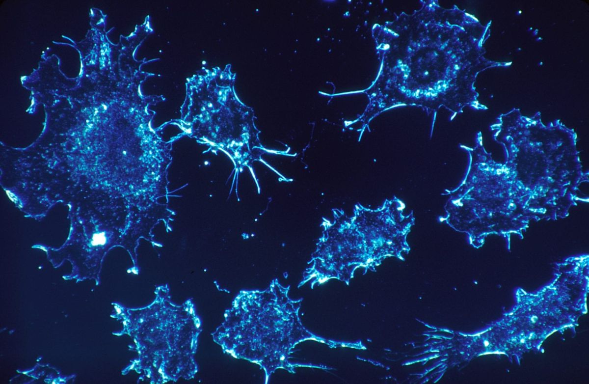 UoM scientists have found a way to stop breast cancer cells from spreading